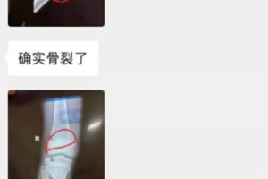 就是她！某青訓(xùn)小孩母親控訴孫繼海和嗨球少年??中國(guó)青訓(xùn)真難